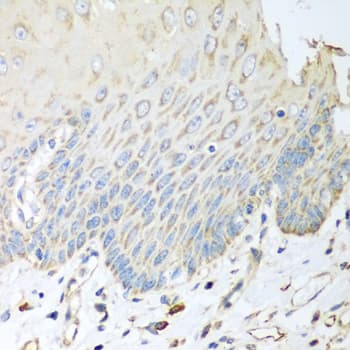 SGCB / SGC / Sarcoglycan Beta Antibody
