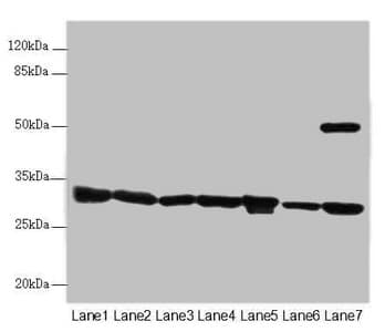 Polyclonal Rabbit anti-Human SCEH / ECHS1 Antibody (IHC, WB)