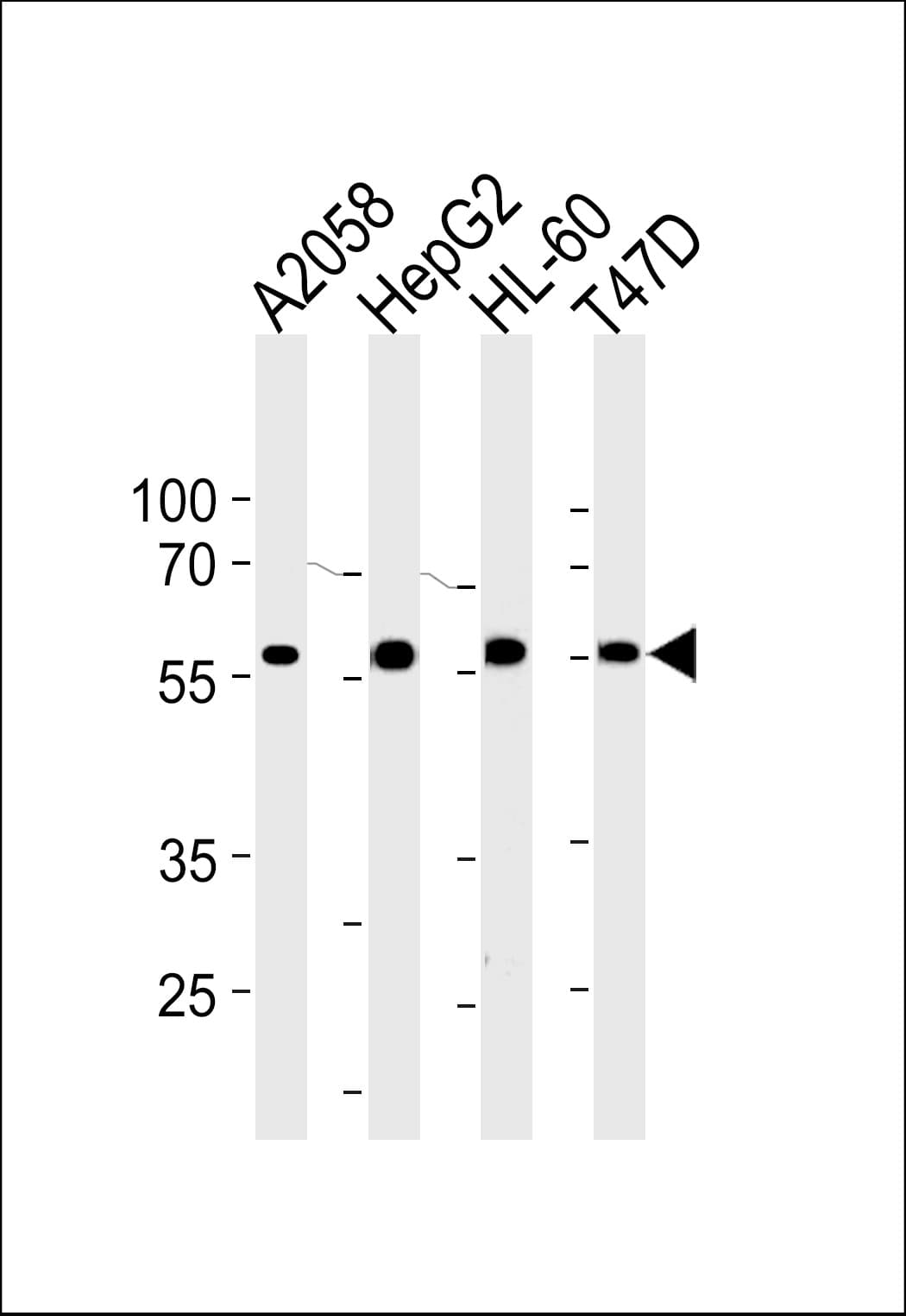 GRN / Granulin Antibody (aa563-591)