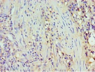 BAFF / TNFSF13B Antibody (aa76-285)