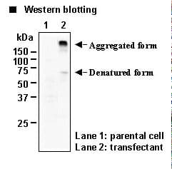 SLC6A2 / NET Antibody (N-Terminal)