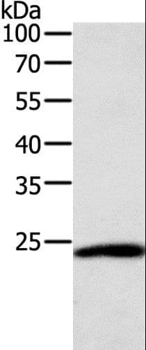 PathPlus™ Polyclonal Rabbit anti-Human SNAP25 Antibody (IHC, WB)