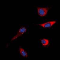 c-Met Antibody (Internal)