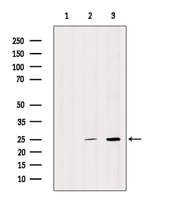 SNRPN Antibody