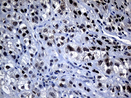 OIP5 Antibody (clone OTI7H9)