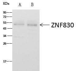 Polyclonal Rabbit anti-Human ZNF830 / CCDC16 Antibody (Preservative Free, IHC, IF, WB)