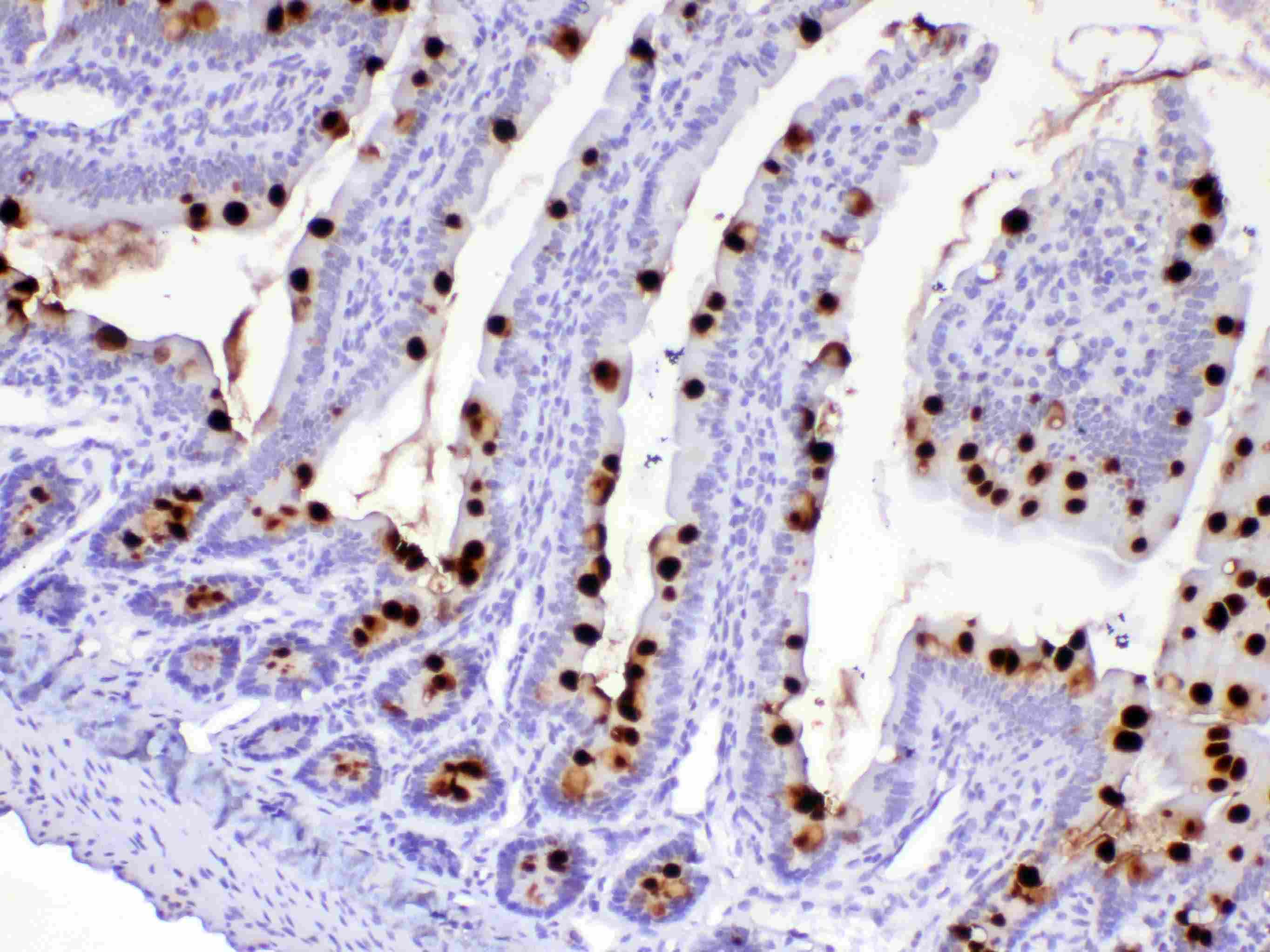Polyclonal Rabbit anti-Human Mucin 2 / MUC2 Antibody (IHC)