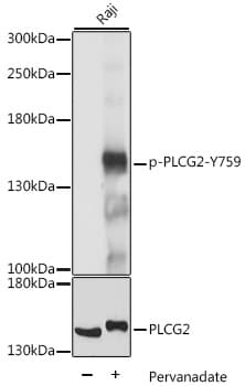 PLCG2 / PLC Gamma 2 Antibody (phospho-Tyr759)