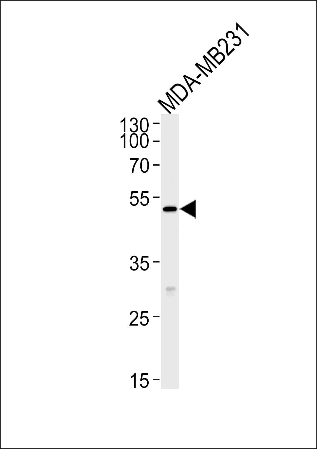 IHC-plus™ MICA Antibody (aa68-97)