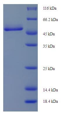 Hamster-Chinese CTSD / Cathepsin D Protein (Recombinant His-SUMO)