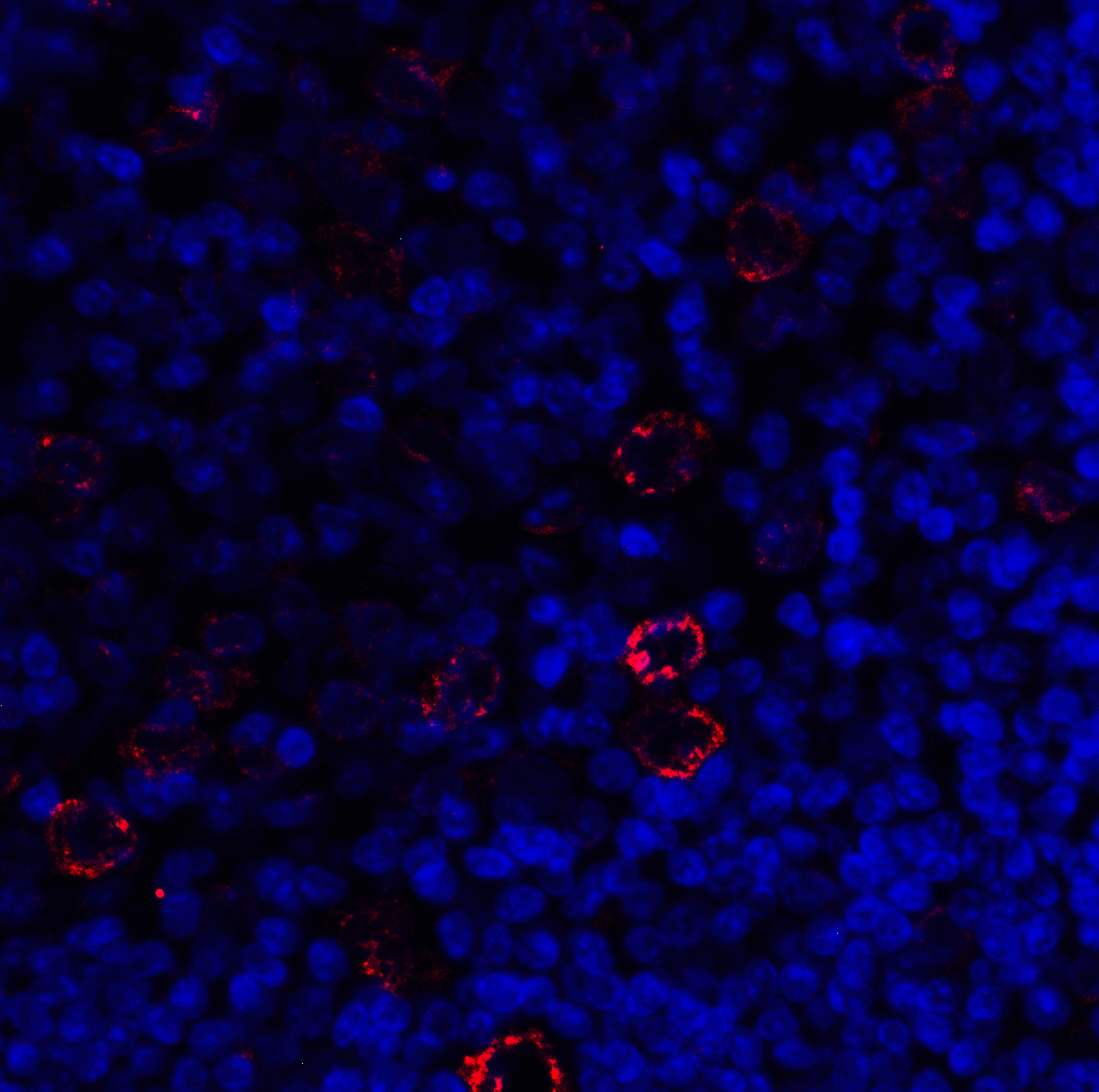 Polyclonal Rabbit anti-Human LAG3 Antibody (IHC, IF, WB)