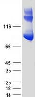 Human ALDH1L1 Protein (Recombinant Myc-DDK (Flag))