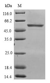 Human CXXC4 Protein (Recombinant GST, N-terminus)