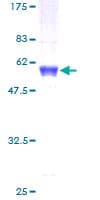 Human NFYB Protein (Recombinant GST)