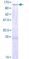 Human SATB2 Protein (Recombinant GST)