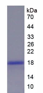 Rhesus monkey IL1RN Protein (Recombinant His)