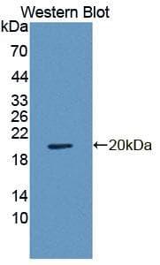 RGS7 Antibody (APC)