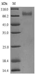 Human KIR2DS3 Protein (Recombinant 6His, N-terminus)