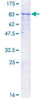 Human MKKS Protein (Recombinant GST)