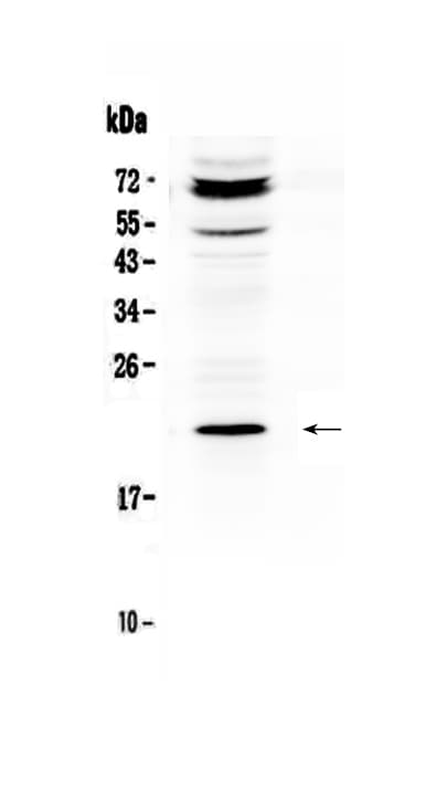 ANGPTL8 / Betatrophin Antibody