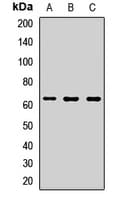 ME1 / Malate Dehydrogenase Antibody