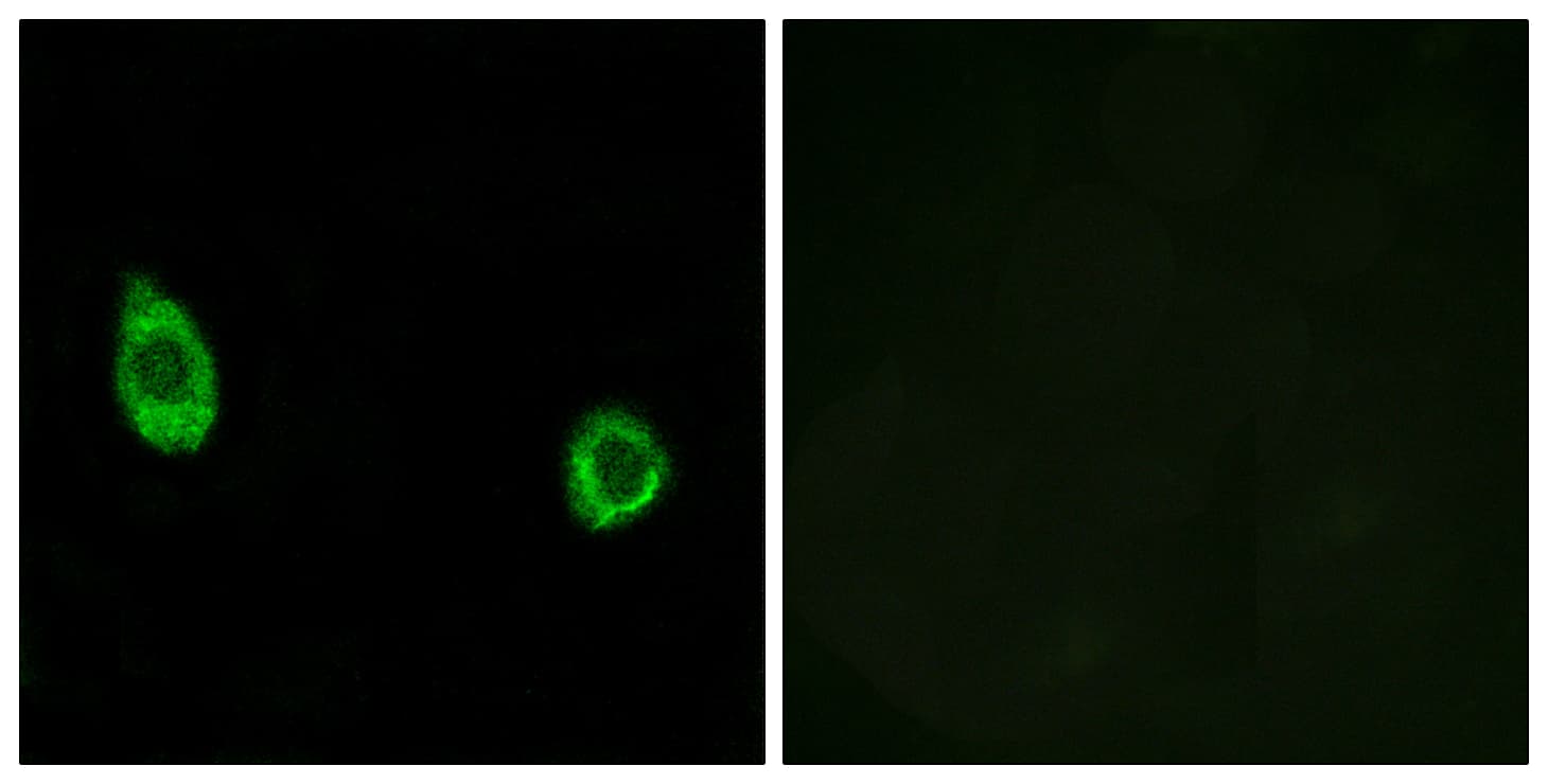 Polyclonal Rabbit anti-Human GALNAC4ST-2 / CHST9 Antibody (aa361-410, IHC, IF)