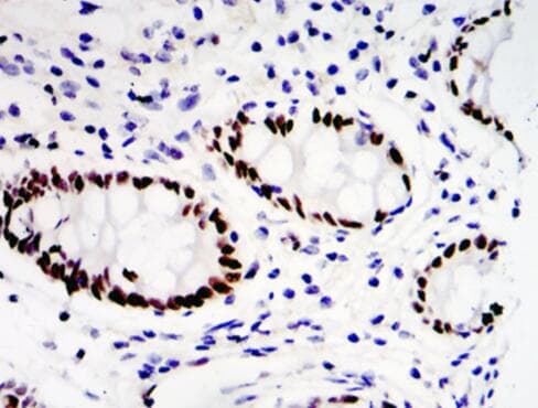 PEA3 / ETV4 Antibody