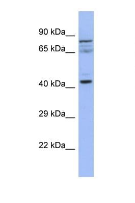 Polyclonal Rabbit anti-Human SLAIN2 Antibody (aa287-336, WB)