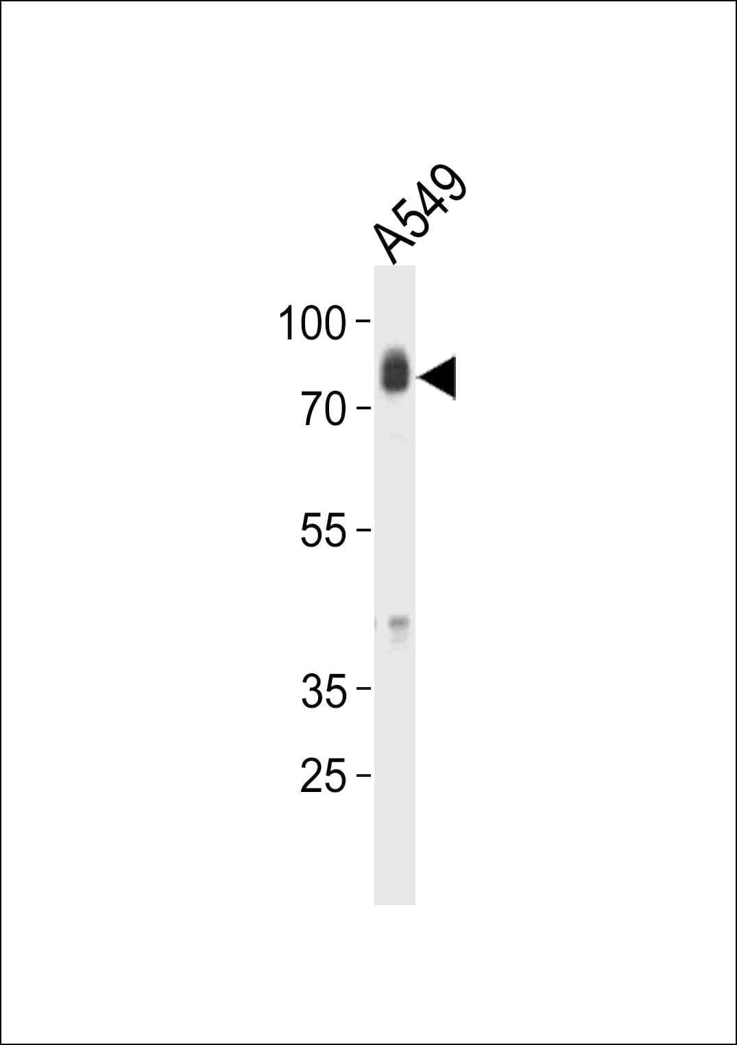 HCK Antibody (aa131-156)