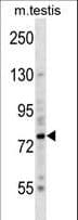 Polyclonal Rabbit anti-Mouse BRSK2 Antibody (aa329-356, WB)