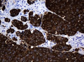 Monoclonal Mouse anti-Human MAGEA3 Antibody (clone 2F10, Carrier-free, IHC, WB)