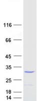 Human TNF Alpha Protein (Recombinant Myc-DDK (Flag))