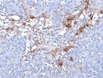 MCAM / CD146 Antibody (clone MUC18/1130)