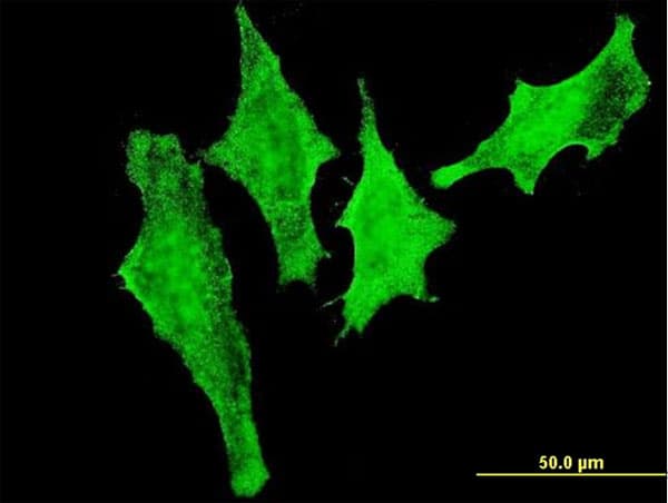 IHC-plus™ Monoclonal Mouse anti-Human PIM1 / Pim-1 Antibody (clone X1, IHC, IF)