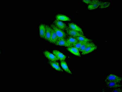 TFDP3 Antibody