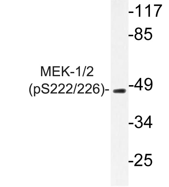 MEK1 + MEK2 Antibody (phospho-Ser222)