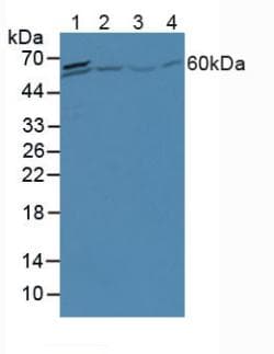 A1CF / ACF Antibody (aa389-587)