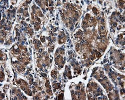 SATB1 Antibody (clone OTI3E12)