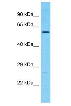 CDK17 / PCTK2 / PCTAIRE2 Antibody (aa474-523)