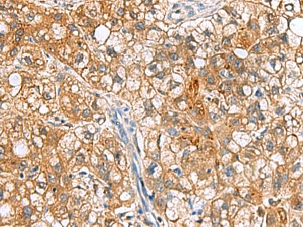 Polyclonal Rabbit anti-Human TTR / Transthyretin Antibody (IHC, WB)
