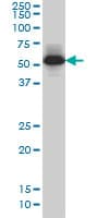 IHC-plus™ MEF2A / MEF2 Antibody (clone 1A10)