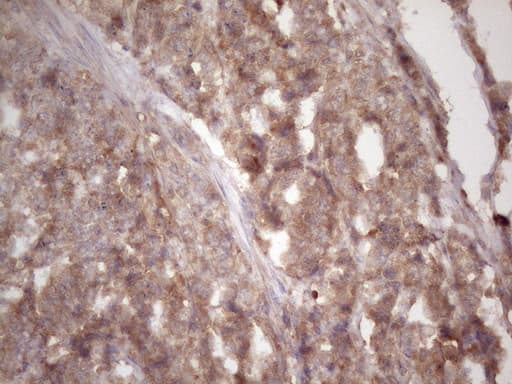 Monoclonal Mouse anti-Human HAVCR2 / TIM-3 Antibody (clone OTI2E2, aa22-202, IHC)