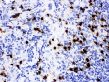 LCN2 / Lipocalin 2 / NGAL Antibody