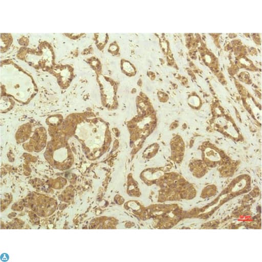 RPS6KB1 / P70S6K / S6K Antibody