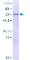Human MBNL2 Protein (Recombinant GST)
