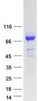 Human MEN1 / Menin Protein (Recombinant Myc-DDK (Flag))