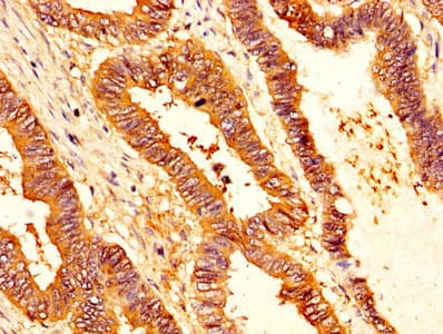 SERPINB1 Antibody (aa1-379)