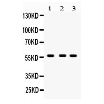 CYP27B1 Antibody (aa475-508)