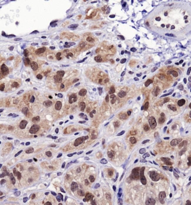 Heat Shock Protein 70 / HSPA1A Antibody