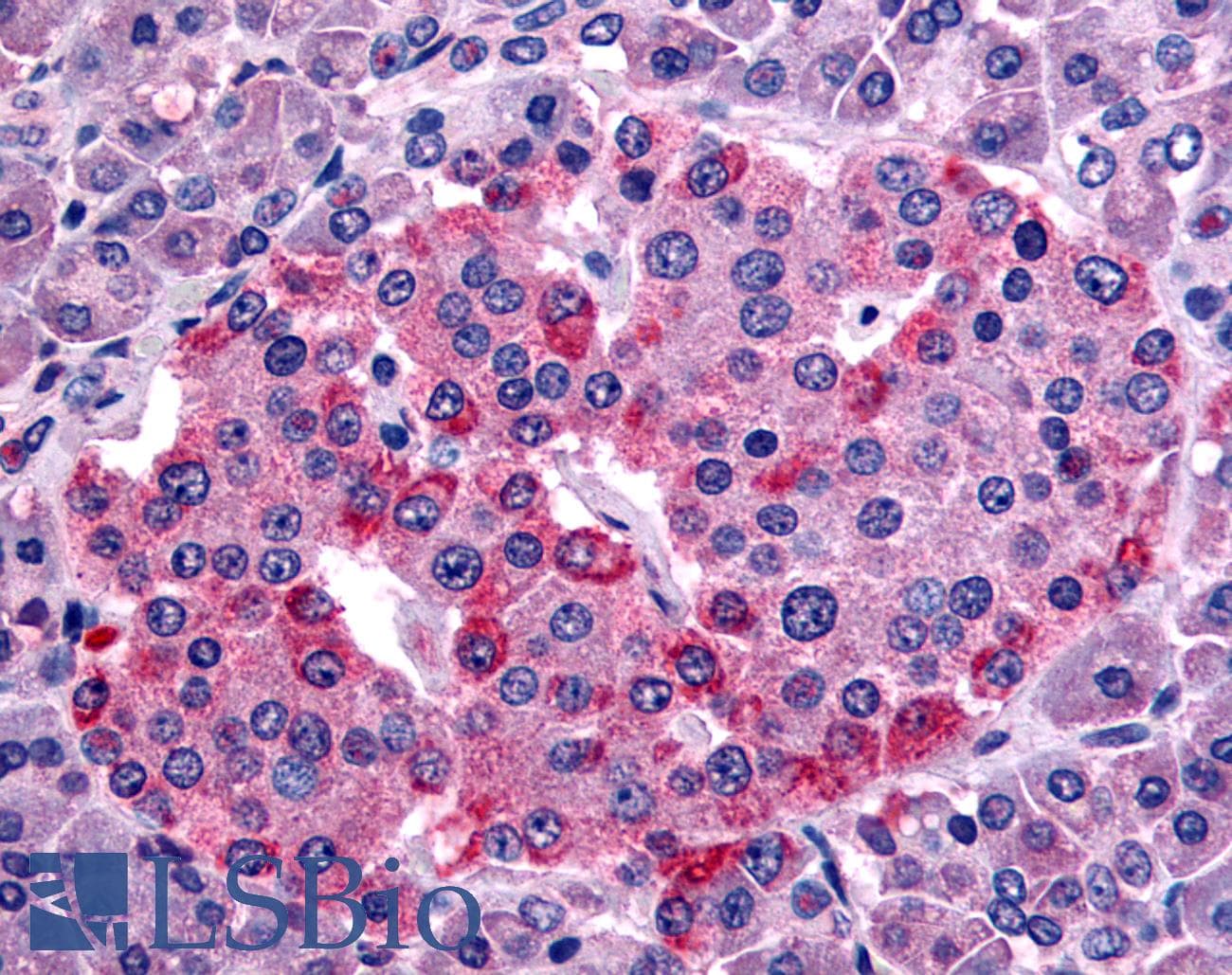 IHC-plus™ SSTR1 Antibody (C-Terminus)